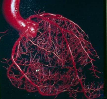 An image of Coronary heart disease (CHD) and Cardiac Rehabilitation